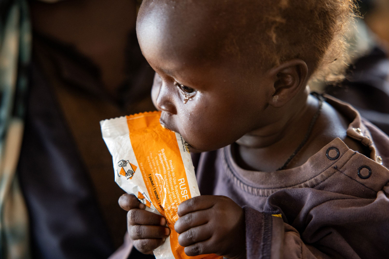 Маленький ребенок лечится от недоедания в клинике по питанию, финансируемой ВПП в Авейле, Южный Судан.